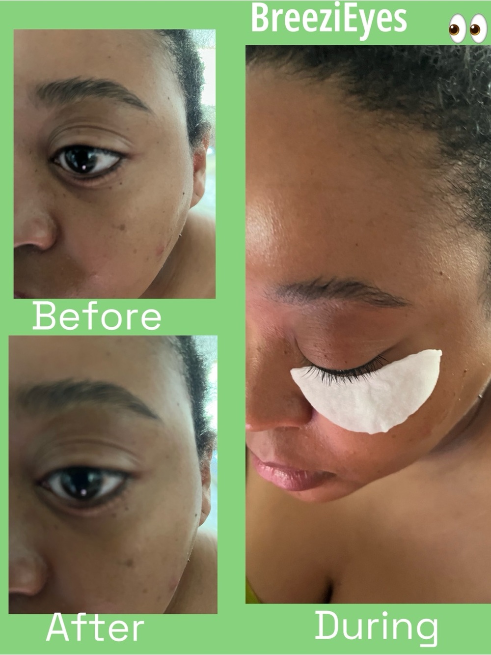 BreeziEyes™ Cooling Eye Pads 👁️❄️ Cooling Eye Pads - - Picture 4 of 9